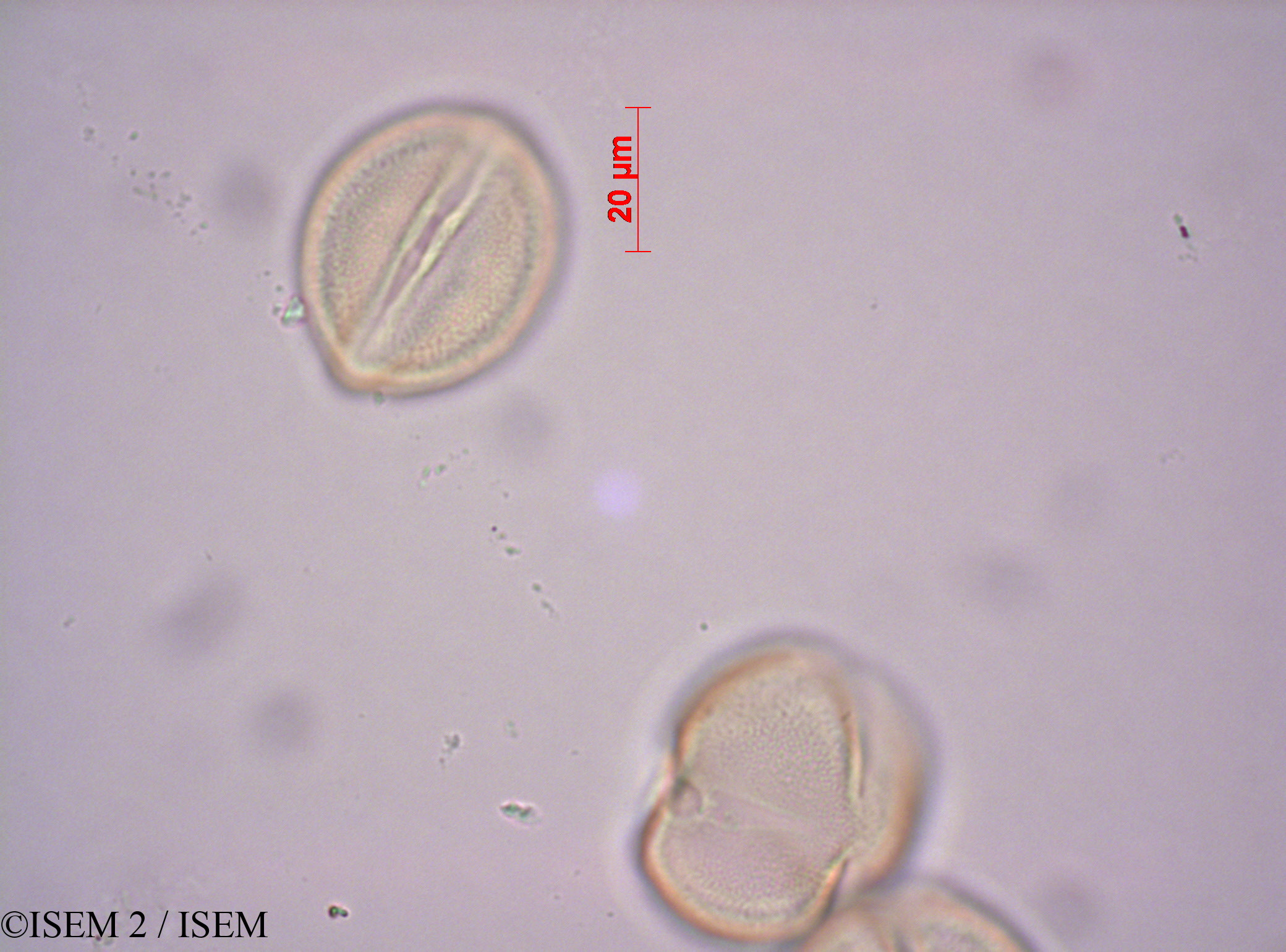 ISEM 2/Elephantorrhiza_suffruticosa_43213/Elephantorrhiza_suffruticosa_43213_0001(copy).jpg